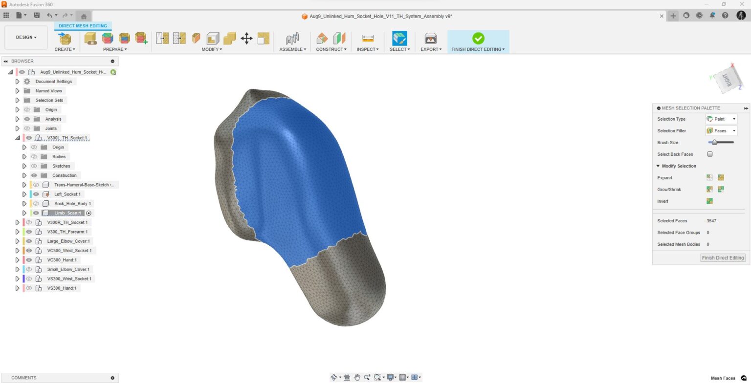 A 3D scan of a patient’s limb displayed in Autodesk Fusion.